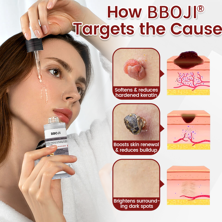 BBOJI® KeraErase Black Rice Renewal Ampoule, Glow Rice Essence Shot - Brightening, Exfoliating & Hydrating Serum, Suitable for All Skin Types.