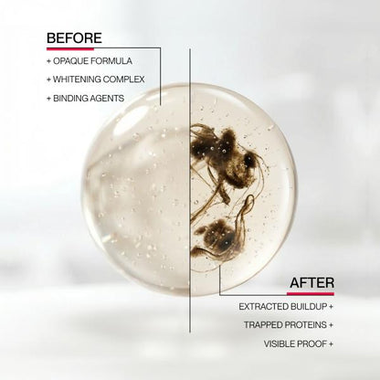 Stain Whitening Mouthwash for White Teeth